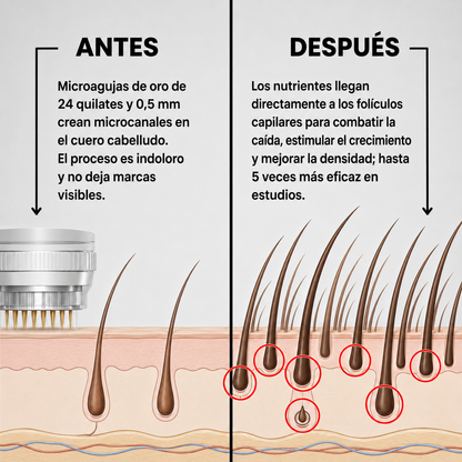 Ciclo de crecimiento del cabello potenciado con Micro-Infusión Capilar