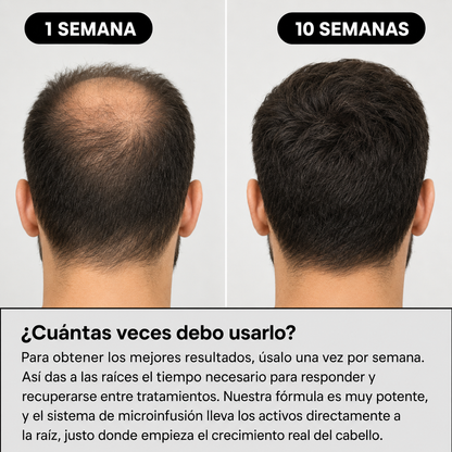 Ejemplo de mayor densidad y crecimiento capilar visible tras el uso del sistema